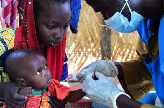Santé : Dr Ben Youssouf Keïta brise les mythes et explique les causes de l’albinisme